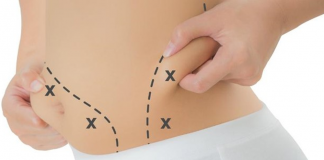 10 fatos que você deve saber antes de optar pela lipoaspiração riscos da lipoaspiração