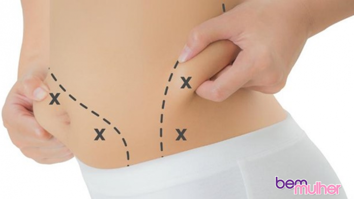 lipoaspiração riscos da lipoaspiração