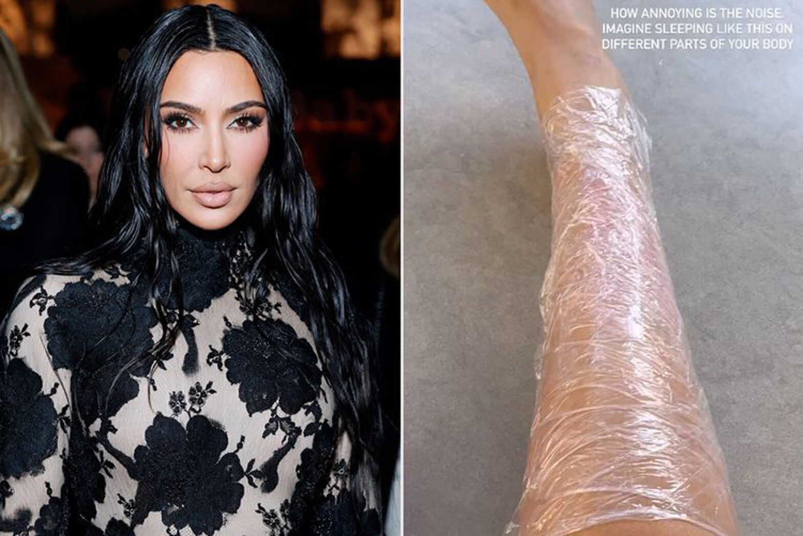 “Isso é doloroso": Kim Kardashian mostra em vídeo lesão causada pela psoríase.